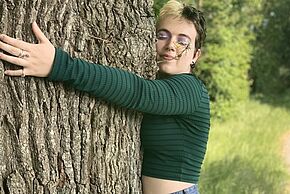 Médecine vasculaire - Lymphœdème - CHU de Montpellier